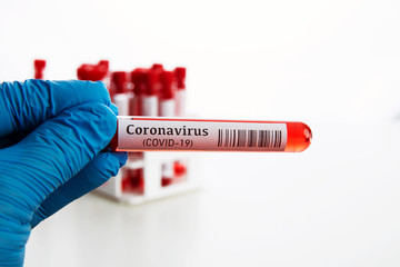 Coronavirus Blood Test in Laboratory
