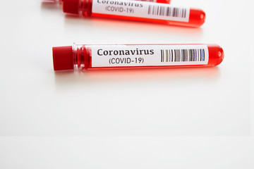 Coronavirus Blood Test in Laboratory