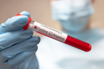 Fototapeta premium Coronavirus positive blood test. Doctor in protective suit, medical mask and latex gloves holds a test tube with blood. 