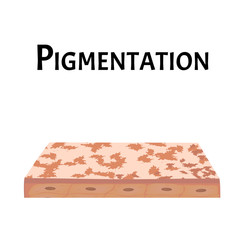 Pigmentation on the skin. A pigmented spot on the skin of the face. Vector illustration