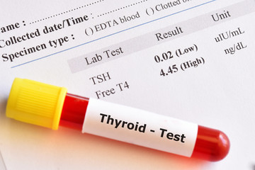 Obraz premium Blood sample tube with abnormal thyroid hormone test result