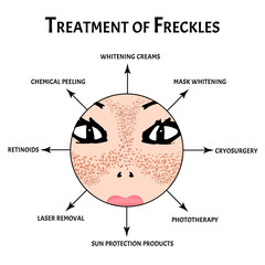 Fototapeta premium Freckles on the face. Pigmentation on the skin. A pigmented spot on the skin of the face. treatment. Vector illustration