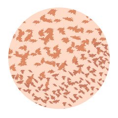 Pigmentation on the skin. A pigmented spot on the skin of the face. Vector illustration
