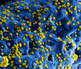 Particula de Covid19, Mers, Coronavirus