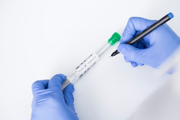 Positive Covid test in the hands of a nurse with blue gloves 