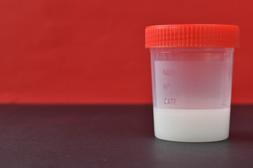 Sperm donation. A sperm sample. Infertility. A jar of analysis.