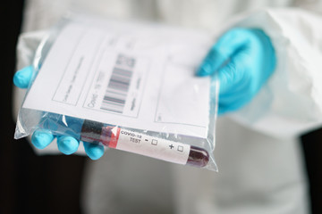 Coronavirus testing, a hand holds transparent bag with tube of blood test samples of coronavirus (COVID-19).