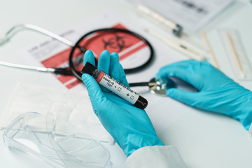 Coronavirus testing, a hand holds tube of blood test samples of coronavirus (COVID-19).