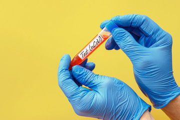 Test tube with blood sample for COVID-19 test, novel coronavirus 2019