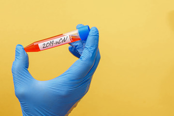 Test tube with blood sample for COVID-19 test, novel coronavirus 2019