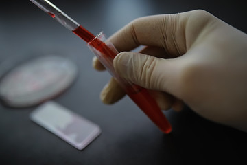 Test tube with patient blood for testing. Analysis for the virus. Coronavirus pandemic laboratory studies. Vaccine development.