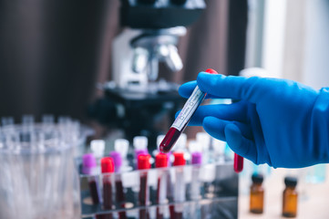 Blood sample test tube for COVID-19 test, novel coronavirus 2019 found in Wuhan, China