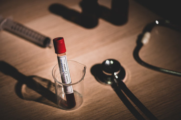 blood test result for the new rapidly spreading Coronavirus, originating in Wuhan, China