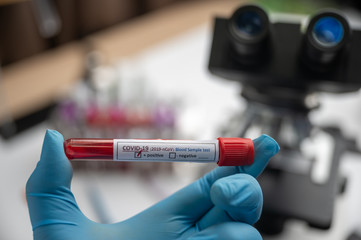 Fototapeta premium Blood test samples for presence of coronavirus (COVID-19) tube containing a blood sample that has tested positive for coronavirus.