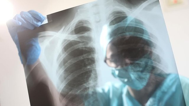 Conceptual video of a doctor holding and analyzing an x-ray of some lungs.