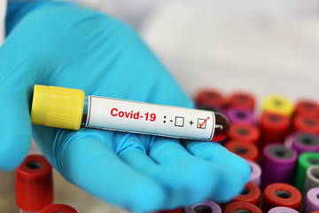 Fototapeta premium Blood sample tube positive with COVID-19 virus 