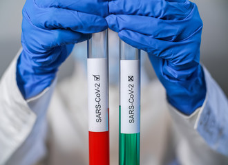 Positive and negative blood test results for SARS-CoV-2, coronavirus causing CONVID-19 disease