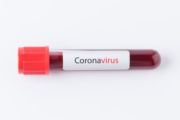 Coronavirus blood test tube