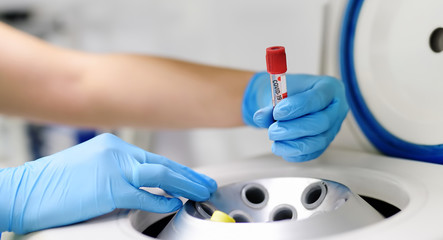 Lab man puts in centrifuge tube with blood for testing coronavirus.Tests for detection virus...