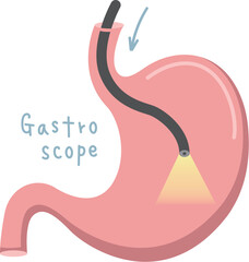 胃のイラスト（胃カメラ）