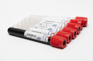 Coronavirus 2019-nCoV Blood Sample. blood for corona, covid-19 virus examination, collected to do a...