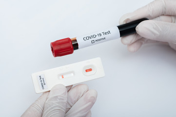 the covid-19 test kit and test tube with contaminated blood sample inside.for check the patient and bring to treat the disease on hospital.
