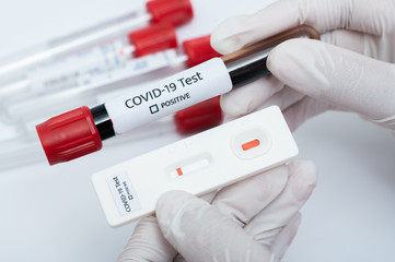 the covid-19 test kit and test tube with contaminated blood sample inside.for check the patient and bring to treat the disease on hospital.