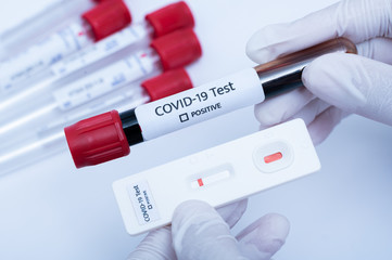 the covid-19 test kit and test tube with contaminated blood sample inside.for check the patient and bring to treat the disease on hospital.