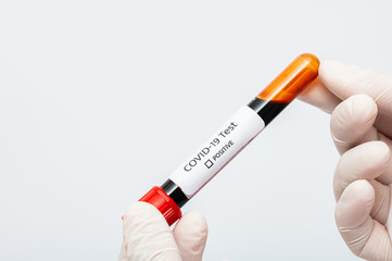 Coronavirus 2019-nCoV Blood Sample. blood for corona, covid-19 virus examination, collected to do a...