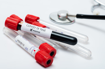Coronavirus 2019-nCoV Blood Sample. blood for corona, covid-19 virus examination, collected to do a...