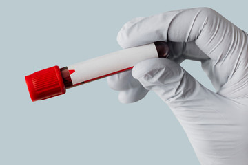 Hand of doctor holding blood tests from covid-19 patient mockup