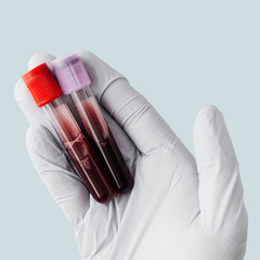 Hand of doctor holding blood tests from covid-19 patient mockup