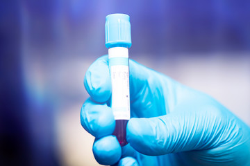 Fototapeta premium COVID-19 - Coronavirus disease - 2019-nCoV.