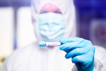 COVID-19 - Coronavirus disease - 2019-nCoV.
