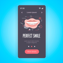 closeup beautiful woman smiling perfect smile dental care and whitening teeth smartphone screen mobile app copy space vector illustration