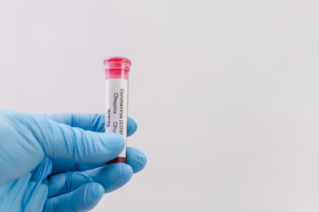 Coronavirus (COVID-19) testng concept, Hand holds a test tube containing a blood sample..