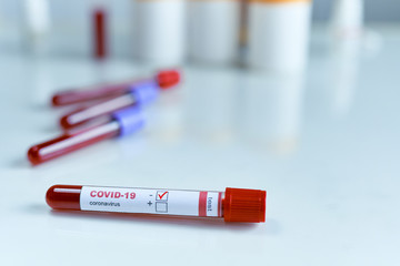 Test tube containing a blood sample, blood test samples for presence of coronavirus with negative result