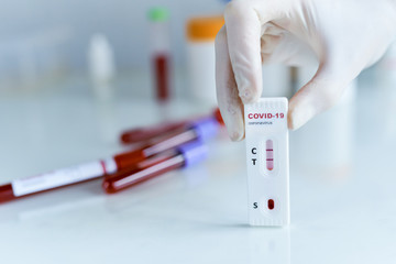 Medic hands in gloves showing positive COVID-19 test, test tubes containing a blood sample on background