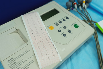 Examination heart diagnosis, cardiogram.