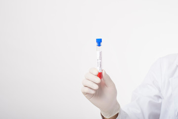 Doctor is holding infected  covid-19  blood test  on white Background