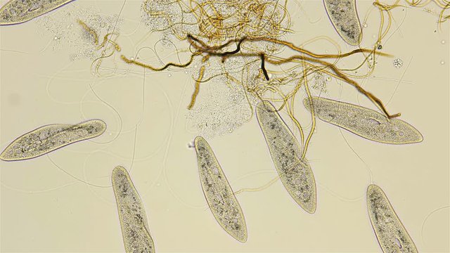 infusoria Param&eacute;cium caud&aacute;tum under microscope, class Oligohymenophorea, order Peniculida, family Parameciidae, lives in fresh water, feeds on decaying organic matter and can be found in an aquarium