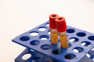 Two test-tubes with plazma in cells, prp laboratory - obrazy, fototapety, plakaty
