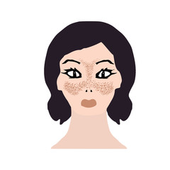 Freckles on the face. Pigmentation on the skin. A pigmented spot on the skin of the face. Before and after treatment. Vector illustration