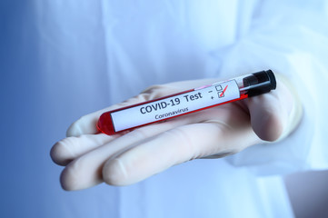 Obraz premium Close up of scientist doctor hand holding a sample test tube with blood for 2019-nCoV analyzing. Conceptual of laboratory testing for the respiratory coronavirus disease 2019 (COVID-19).