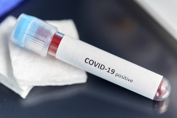 Obraz premium medicine, healthcare and pandemic concept - close up of beaker with positive coronavirus blood test on table at laboratory