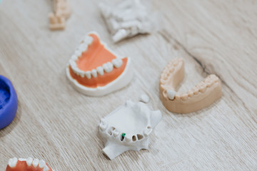 Plastic jaw model for stomatology and maxillofacial surgery.