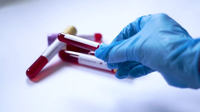 Coronavirus positive, COVID-19, Coronavirus Infected Blood