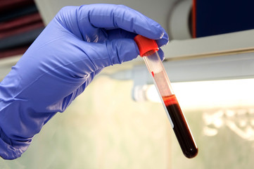 blood test tube in hand close up with blurred background