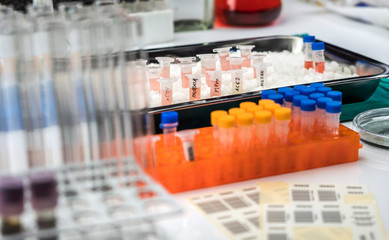 Vials with samples of SARS-COV-2 Covid-19 prepared cold in a hospital, conceptual image