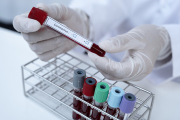 The picture of doctor's hand holding blood tube coronavirus test in white background